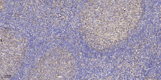 Shc (phospho Ser36) Rabbit Polyclonal Antibody