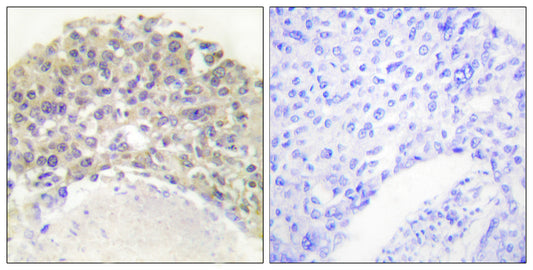 Shc (phospho Tyr349) Rabbit Polyclonal Antibody