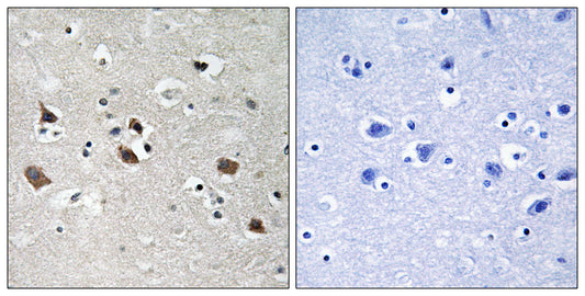 SLP-76 (phospho Tyr128) Rabbit Polyclonal Antibody