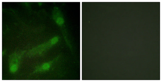 Smad2 (phospho Thr220) Rabbit Polyclonal Antibody