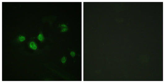 Sp1 (phospho Thr453) Rabbit Polyclonal Antibody