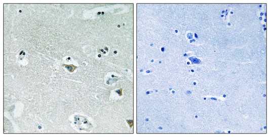 SREBP-1 (phospho Ser439) Rabbit Polyclonal Antibody