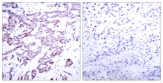 Stat6 (phospho Thr645) Rabbit Polyclonal Antibody