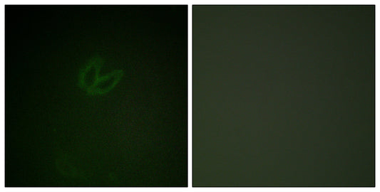 Syk (phospho Tyr323) Rabbit Polyclonal Antibody
