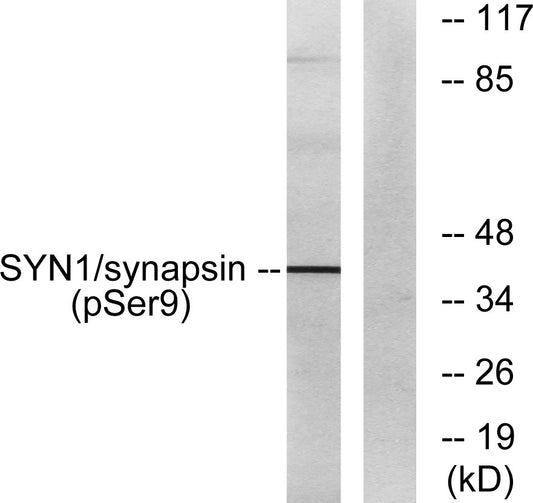 Synapsin I (phospho Ser9) Rabbit Polyclonal Antibody