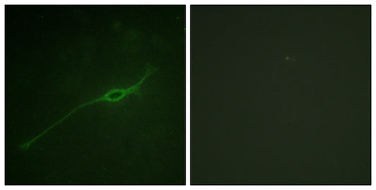 Syntaxin 1 (phospho Ser14) Rabbit Polyclonal Antibody