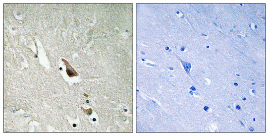 Tak1 (phospho Ser439) Rabbit Polyclonal Antibody