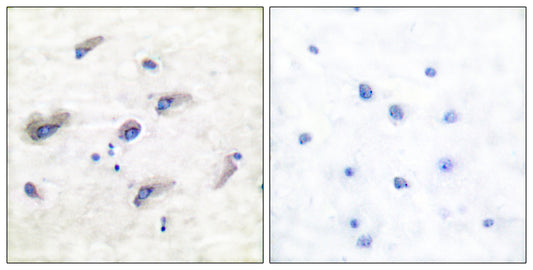Tau (phospho Ser356) Rabbit Polyclonal Antibody