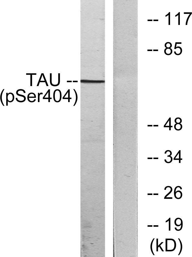 Tau (phospho Ser404) Rabbit Polyclonal Antibody