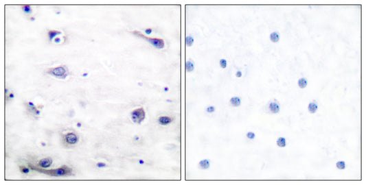 Tau (phospho Ser422) Rabbit Polyclonal Antibody