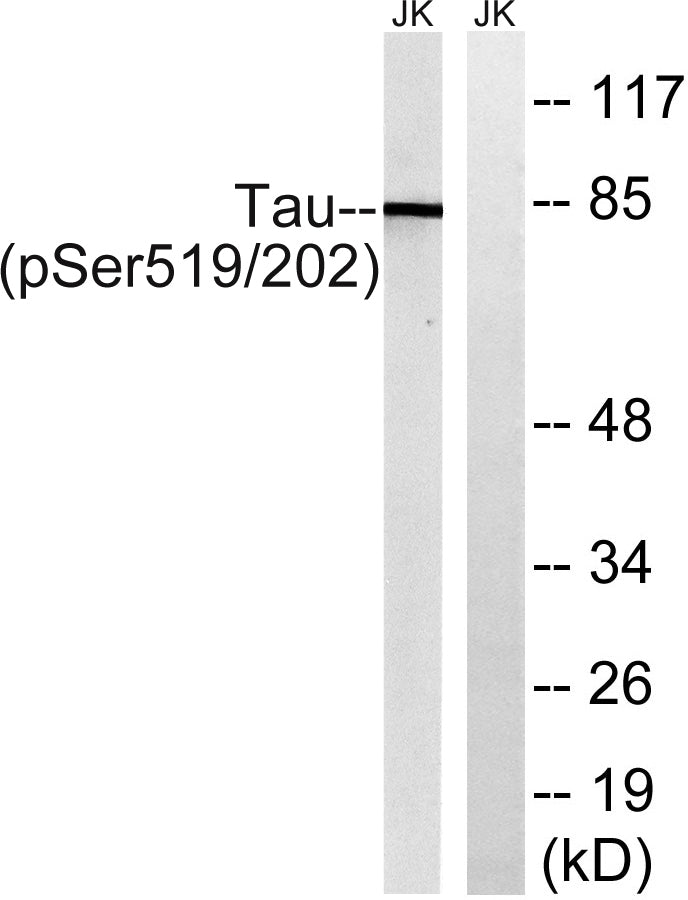 Tau (phospho Ser519) Rabbit Polyclonal Antibody