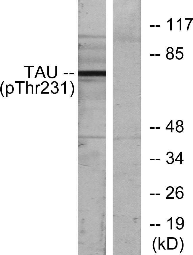 Tau (phospho Thr231) Rabbit Polyclonal Antibody
