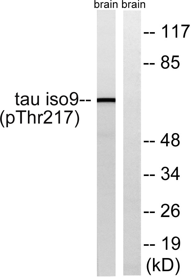 Tau (phospho Thr534) Rabbit Polyclonal Antibody