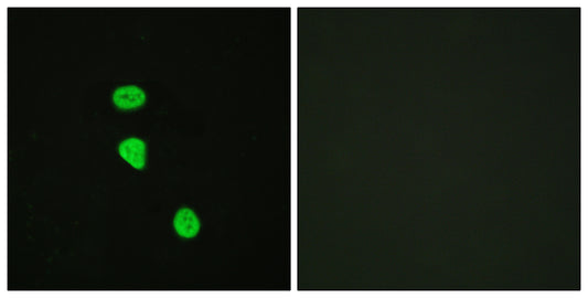 TBC1D4 (phospho Thr642) Rabbit Polyclonal Antibody
