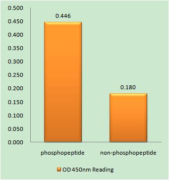 TGFβ RII (phospho Ser225) Rabbit Polyclonal Antibody
