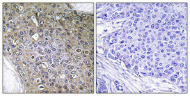 TGFβ RIII (phospho Thr842) Rabbit Polyclonal Antibody
