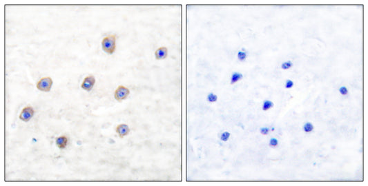 TH (phospho Ser62) Rabbit Polyclonal Antibody