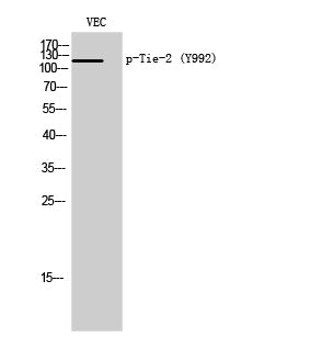 Tie-2 (phospho Tyr992) Rabbit Polyclonal Antibody