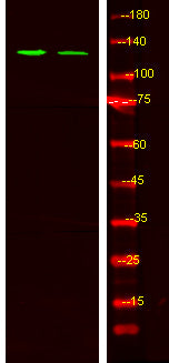 Tie2 (phospho-Ser1119) Rabbit Polyclonal Antibody