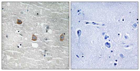 TOB1 (phospho Ser164) Rabbit Polyclonal Antibody