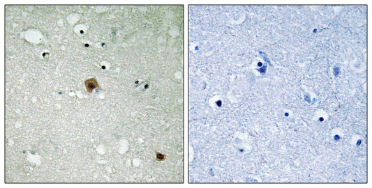 Topo IIα (phospho Ser1525) Rabbit Polyclonal Antibody