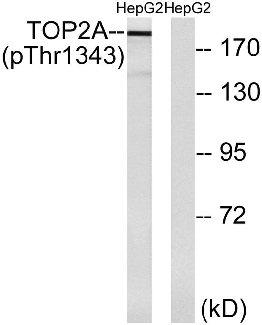 Topo IIα (phospho Thr1343) Rabbit Polyclonal Antibody