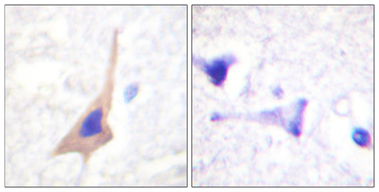 TPH1 (phospho Ser58) Rabbit Polyclonal Antibody