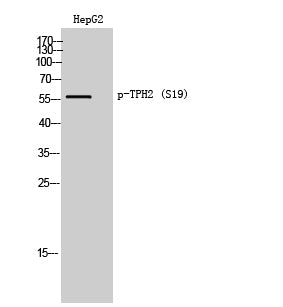 TPH2 (phospho Ser19) Rabbit Polyclonal Antibody