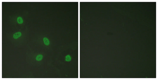 TRAP220 (phospho Thr1457) Rabbit Polyclonal Antibody