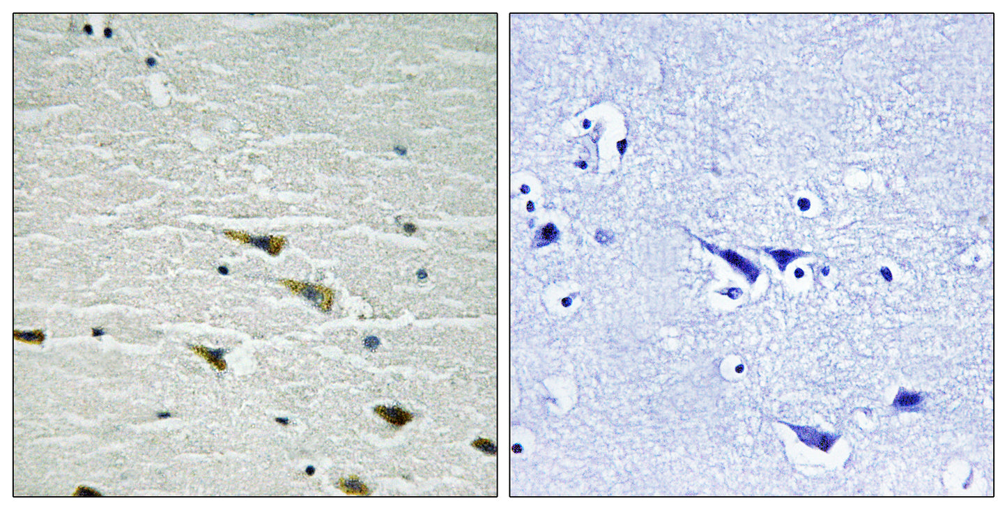 Trk A (phospho Tyr757) Rabbit Polyclonal Antibody