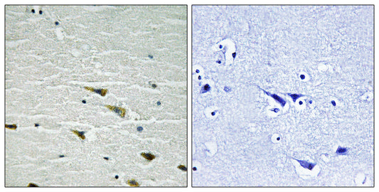 Trk A (phospho Tyr757) Rabbit Polyclonal Antibody