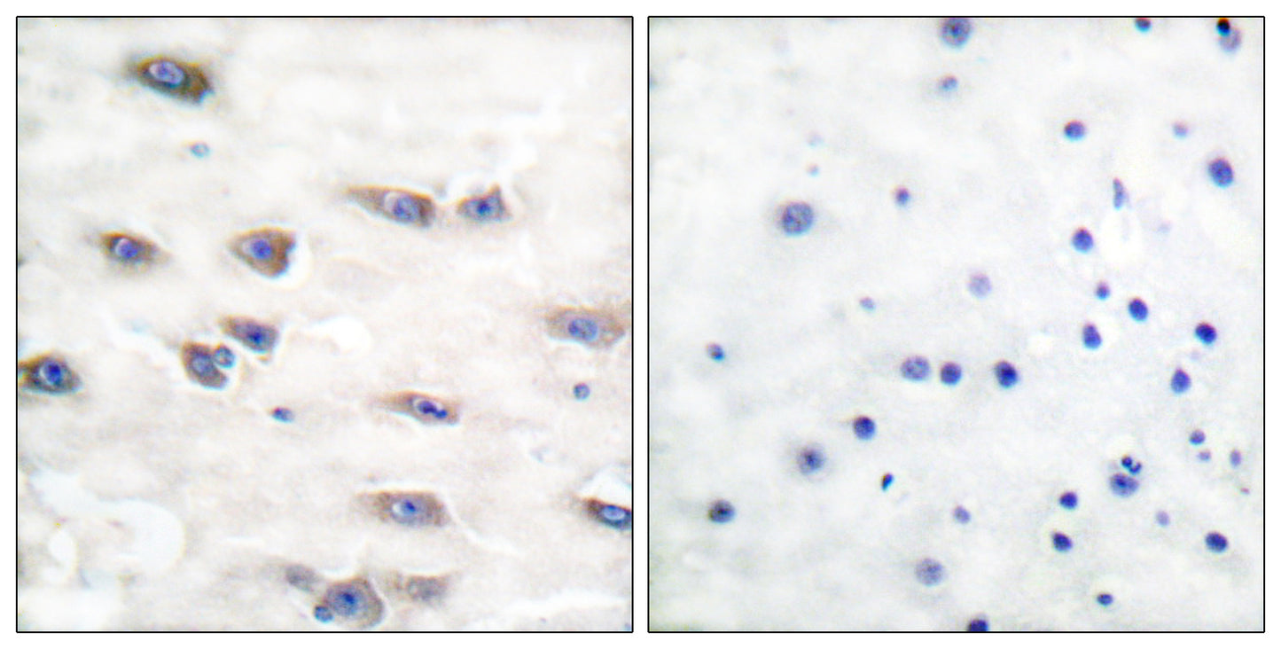 Trk A (phospho Tyr791) Rabbit Polyclonal Antibody