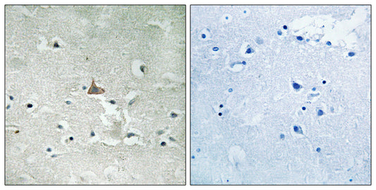 Trk B (phospho Tyr706/Y707) Rabbit Polyclonal Antibody