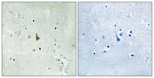 Trk C (phospho Tyr516) Rabbit Polyclonal Antibody