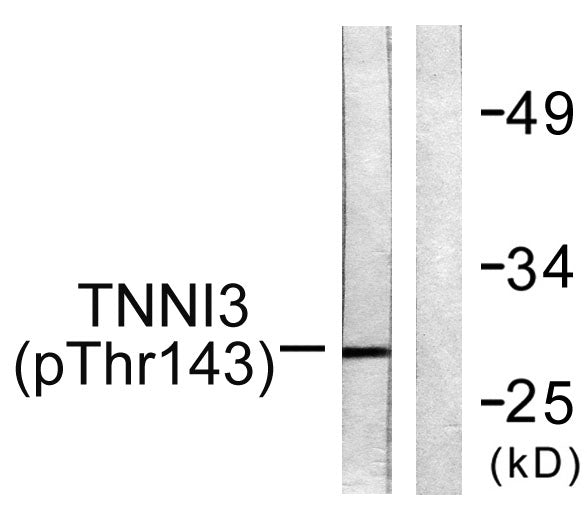Troponin I-C (phospho Thr142) Rabbit Polyclonal Antibody