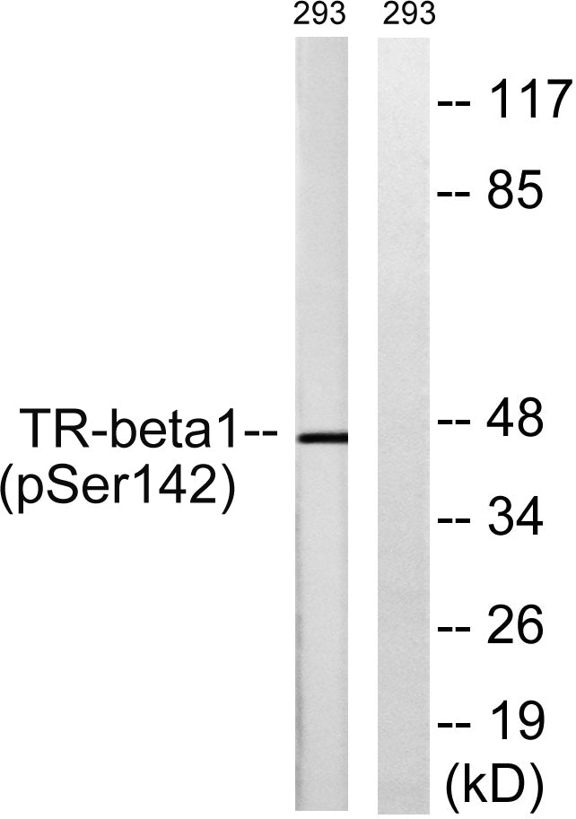 TRβ1 (phospho Ser142) Rabbit Polyclonal Antibody