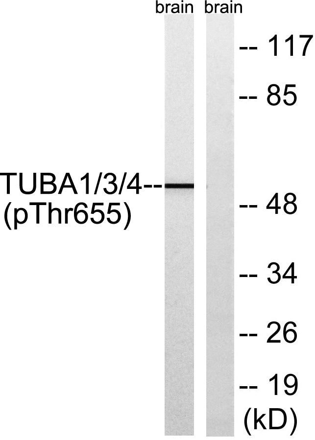 Tubulin α1/3/4 (phospho Tyr272) Rabbit Polyclonal Antibody