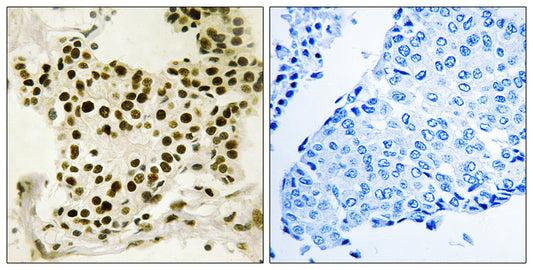 UBF (phospho Ser484) Rabbit Polyclonal Antibody