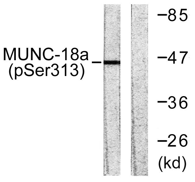 Unc18-1 (phospho Ser313) Rabbit Polyclonal Antibody