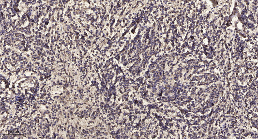 VASP (phospho Thr278) Rabbit Polyclonal Antibody