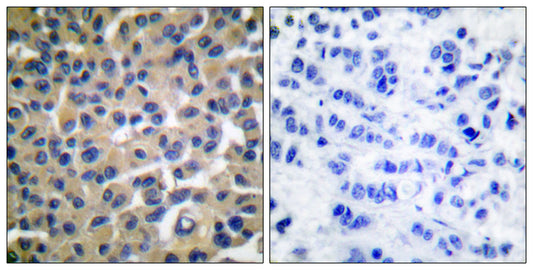 Vav (phospho Tyr174) Rabbit Polyclonal Antibody