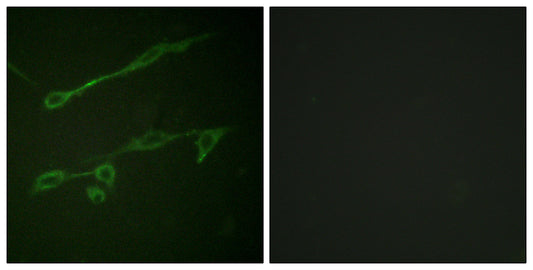 Vav2 (phospho Tyr142) Rabbit Polyclonal Antibody