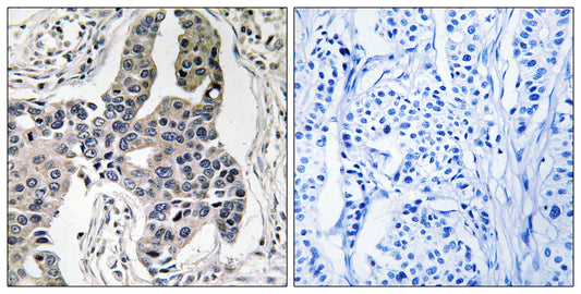 Vimentin (phospho Ser83) Rabbit Polyclonal Antibody