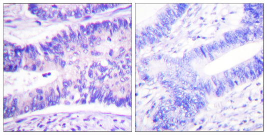 WAVE1 (phospho Tyr125) Rabbit Polyclonal Antibody