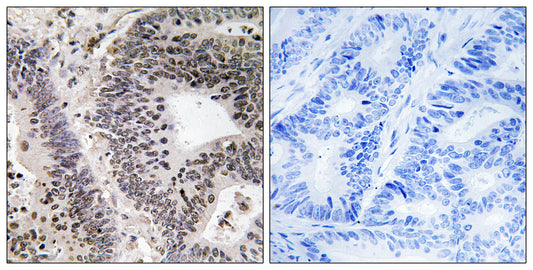 WWOX (phospho Tyr33) Rabbit Polyclonal Antibody