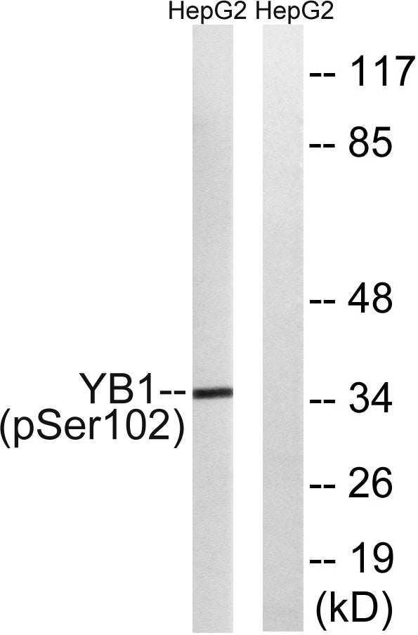 YB-1 (phospho Ser102) Rabbit Polyclonal Antibody