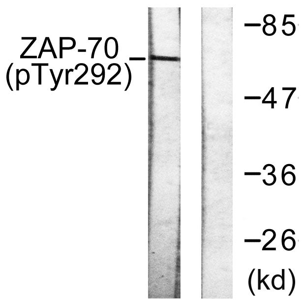 ZAP-70 (phospho Tyr292) Rabbit Polyclonal Antibody