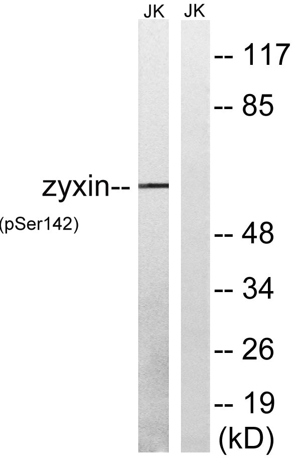 Zyxin (phospho Ser142) Rabbit Polyclonal Antibody