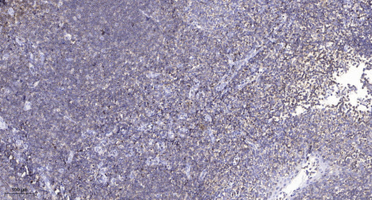 CFTR (Phospho-Ser737) Rabbit Polyclonal Antibody