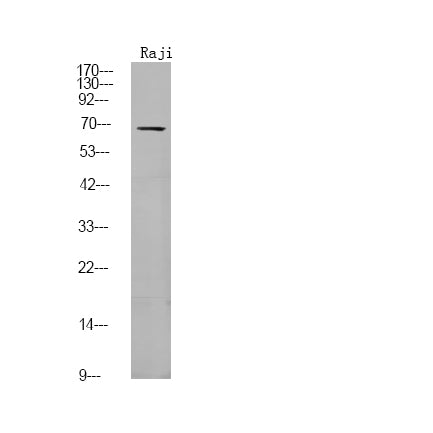 FGR (Phospho-Tyr412) Rabbit Polyclonal Antibody